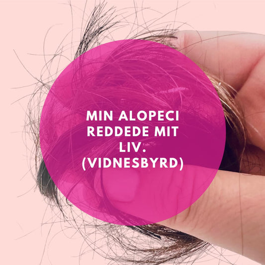 Løst hår som indikerer hårtab. Pink cirkel henover med tekst: Min alopeci reddede mit liv (et vidnesbyrd)