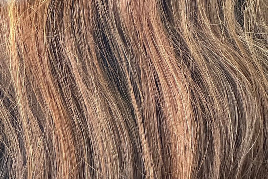 Når hårtab er kronisk: Accept, behandling og vejen ud af den onde cirkel